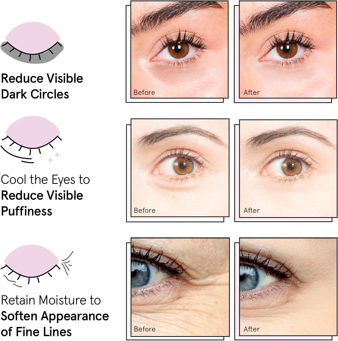 grace & stella Award Winning Under Eye Mask - Reduce Dark Circles, Puffy