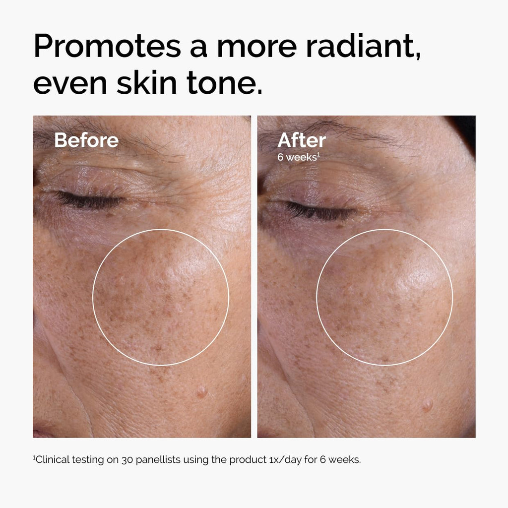 The Ordinary Glycolic Acid 7% Exfoliating Toner, Brightening and Smoothing
